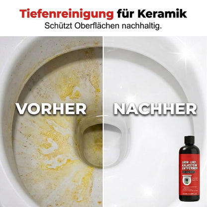 🚽✨🧼 Kraftvoller Urinstein-Entferner